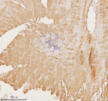 MAP4K3 Rabbit Polyclonal Antibody