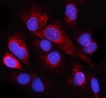 NUP98 Rabbit Polyclonal Antibody