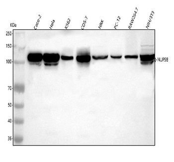 NUP98 Rabbit Polyclonal Antibody