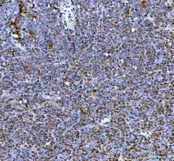 NR1D2 Rabbit Polyclonal Antibody