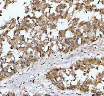 NR1D2 Rabbit Polyclonal Antibody