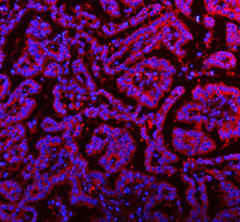 RNF25 Antibody