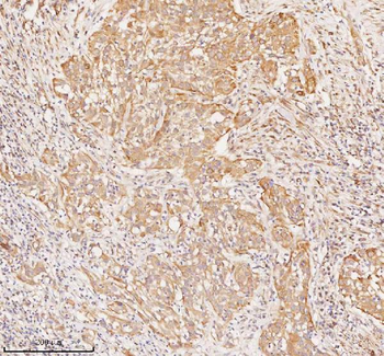 RNF25 Antibody