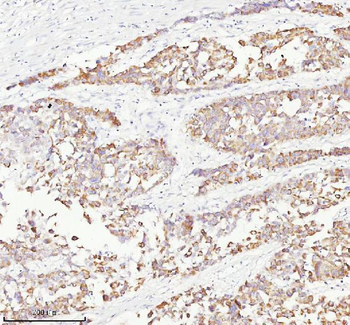 RGL3 Rabbit Polyclonal Antibody