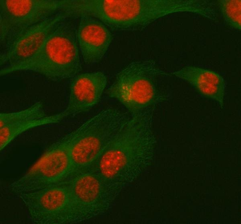 RBM42 Rabbit Polyclonal Antibody