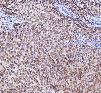 RBM42 Rabbit Polyclonal Antibody