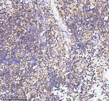 RBM42 Rabbit Polyclonal Antibody