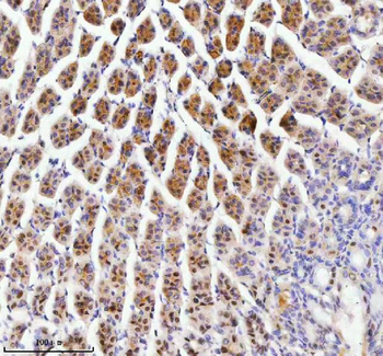 RBM42 Rabbit Polyclonal Antibody