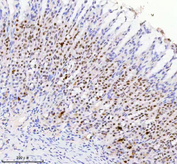 RBM42 Rabbit Polyclonal Antibody