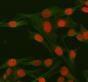 RBBP8 Rabbit Polyclonal Antibody