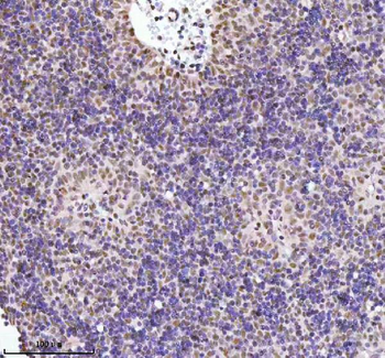 RBBP8 Rabbit Polyclonal Antibody