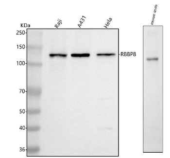 RBBP8 Rabbit Polyclonal Antibody