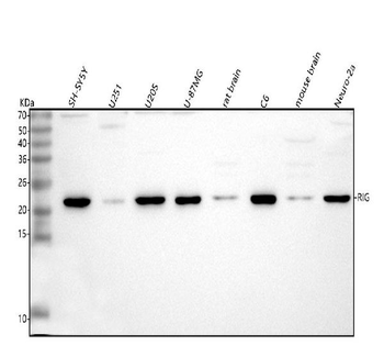 DKK3/RIG Antibody