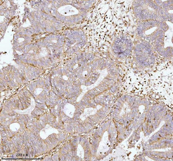 GNAI2 Rabbit Polyclonal Antibody