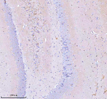 GNAI2 Rabbit Polyclonal Antibody