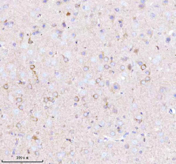 GNAI2 Rabbit Polyclonal Antibody