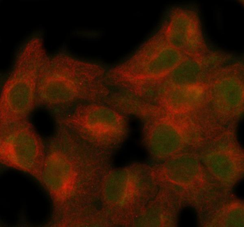 SECISBP2 Rabbit Polyclonal Antibody