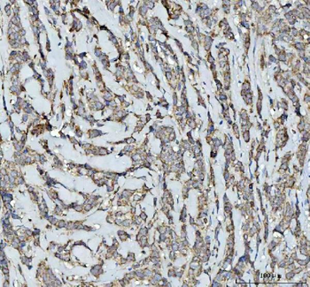 SQRDL/SQOR Rabbit Polyclonal Antibody