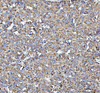 SQRDL/SQOR Rabbit Polyclonal Antibody