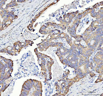 SQRDL/SQOR Rabbit Polyclonal Antibody