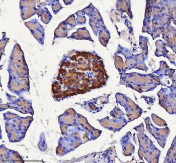 NPTX2 Rabbit Polyclonal Antibody