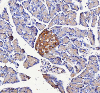 NPTX2 Rabbit Polyclonal Antibody