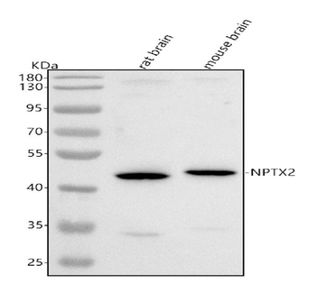 NPTX2 Rabbit Polyclonal Antibody