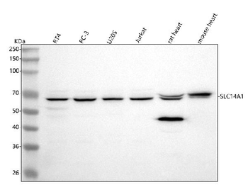 UT-B/SLC14A1/UT Rabbit Polyclonal Antibody