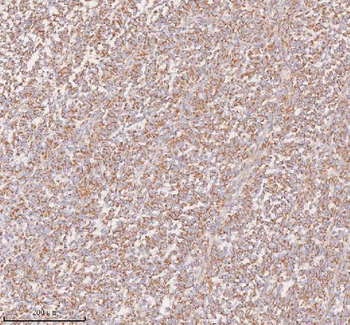 UT-B/SLC14A1/UT Rabbit Polyclonal Antibody