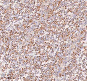 UT-B/SLC14A1/UT Rabbit Polyclonal Antibody