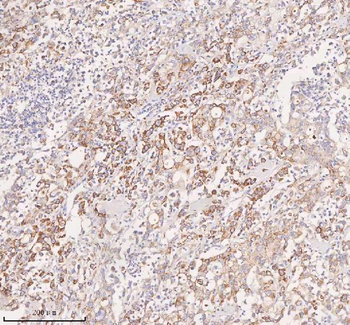 UT-B/SLC14A1/UT Rabbit Polyclonal Antibody