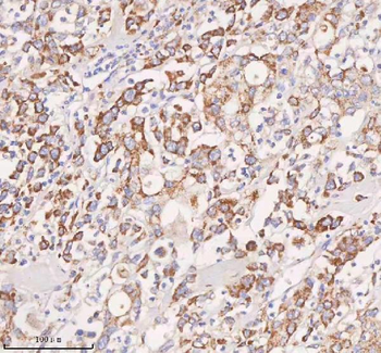 UT-B/SLC14A1/UT Rabbit Polyclonal Antibody
