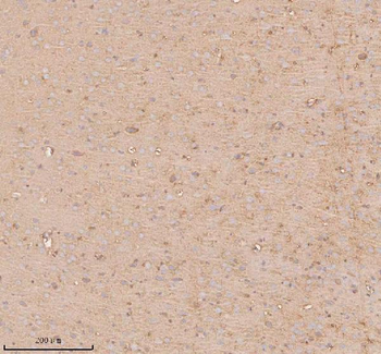 UT-B/SLC14A1/UT Rabbit Polyclonal Antibody