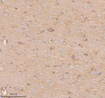 UT-B/SLC14A1/UT Rabbit Polyclonal Antibody