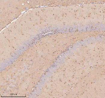 UT-B/SLC14A1/UT Rabbit Polyclonal Antibody