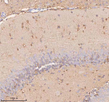 UT-B/SLC14A1/UT Rabbit Polyclonal Antibody