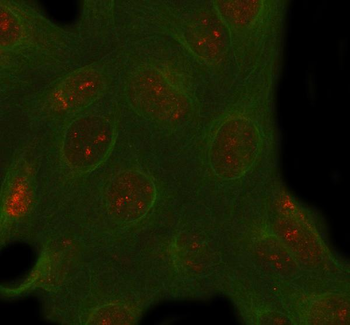 PACSIN1 Rabbit Polyclonal Antibody