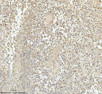 PACSIN1 Rabbit Polyclonal Antibody