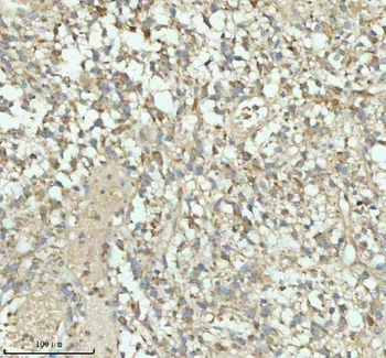 PACSIN1 Rabbit Polyclonal Antibody
