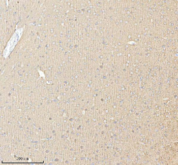 PACSIN1 Rabbit Polyclonal Antibody