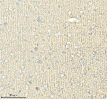 PACSIN1 Rabbit Polyclonal Antibody