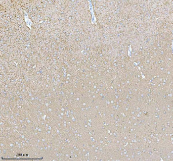 PACSIN1 Rabbit Polyclonal Antibody