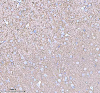 PACSIN1 Rabbit Polyclonal Antibody