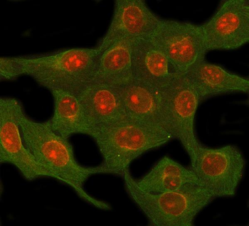 NUP62 Rabbit Polyclonal Antibody
