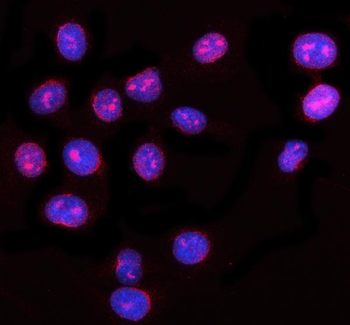 NUP62 Rabbit Polyclonal Antibody