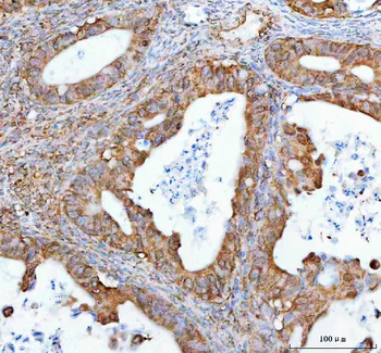 NUP62 Rabbit Polyclonal Antibody