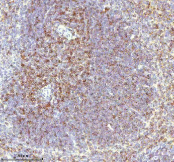 Lat Rabbit Polyclonal Antibody