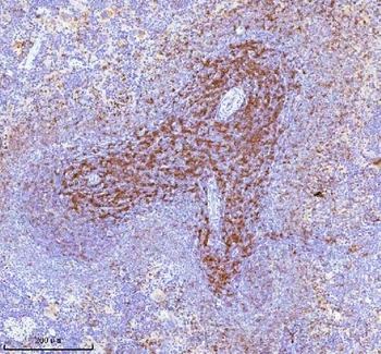 Lat Rabbit Polyclonal Antibody