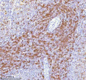 Lat Rabbit Polyclonal Antibody