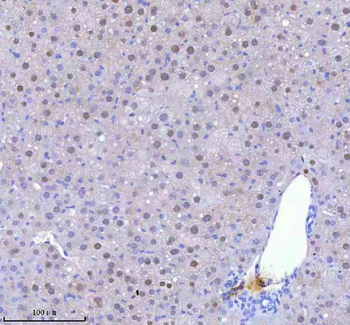 BCCIP Rabbit Polyclonal Antibody